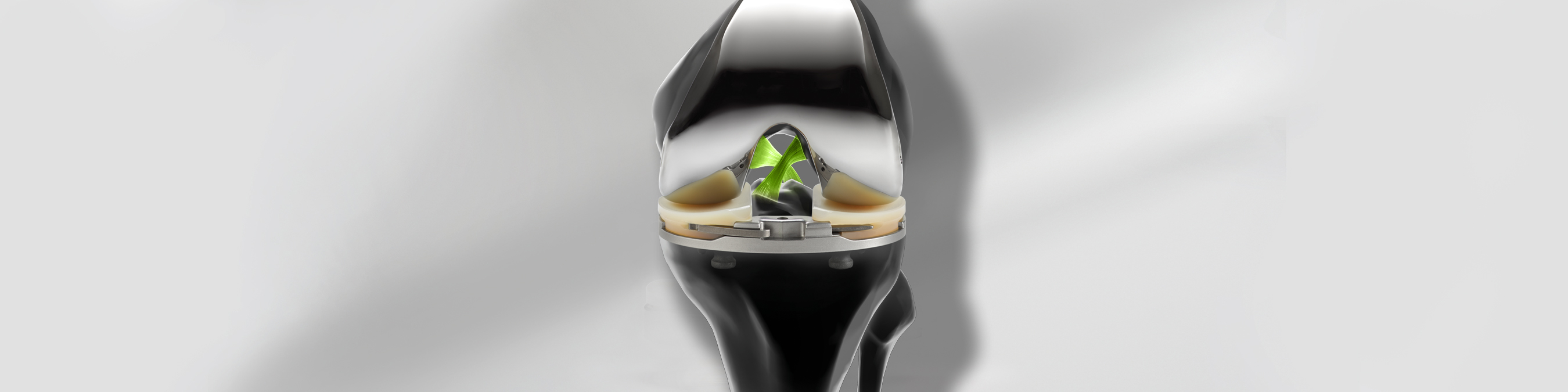 Vanguard XP Total Knee System KNEES ジンマーバイオメット